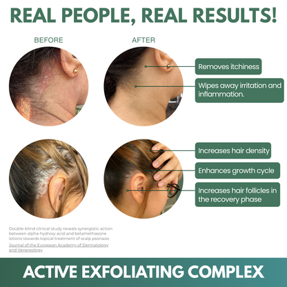 LISSIMA Natural Scalp Scrub – for Flaky, Itchy, Irritated Scalp (Sensitive Care)